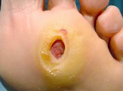 Terapia manual en Fisioterapia y Podología Canal